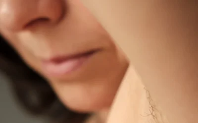 Does Waxing Cause Ingrown Hairs? Causes, Prevention & Treatment